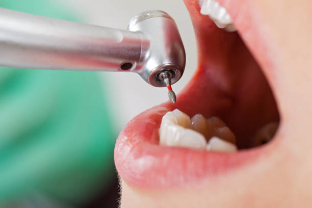 Best Weekend Emergency Dental Services in New Lno, LA